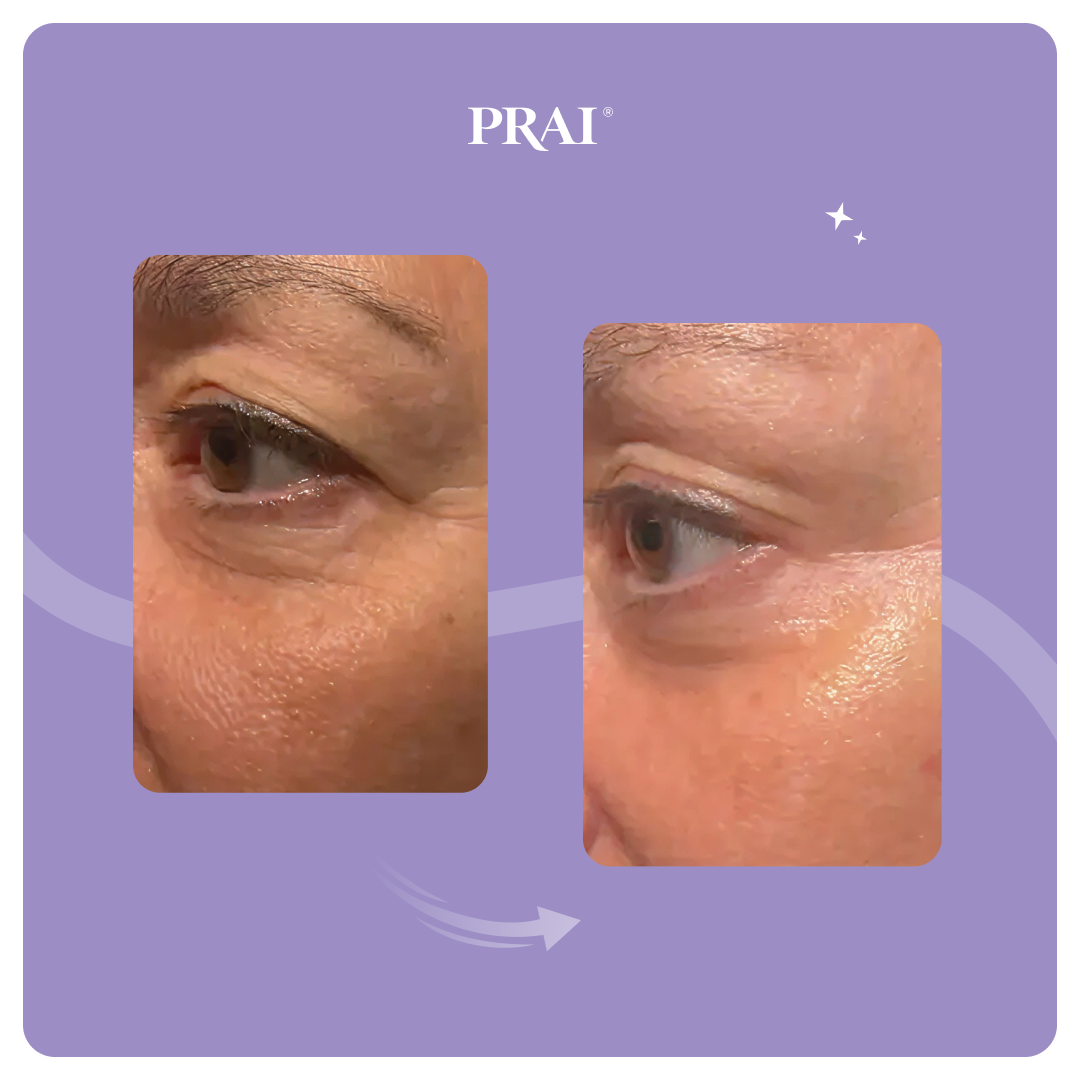 Ageless Eye Tight Uplift Serum-Ageless Eye Tight Uplift Serum