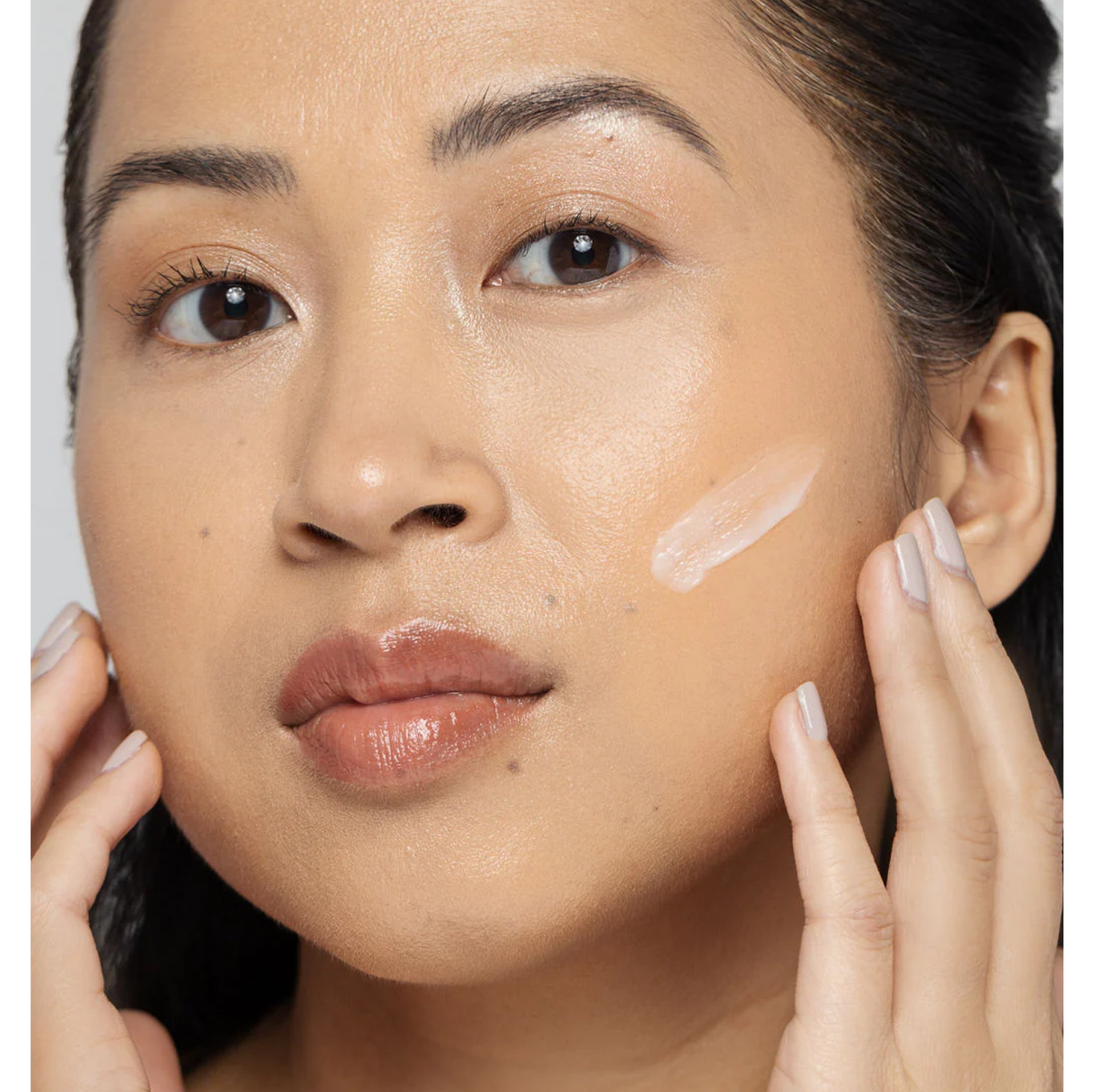 Vivier Acne Treatment Lotion-Vivier Acne Treatment Lotion