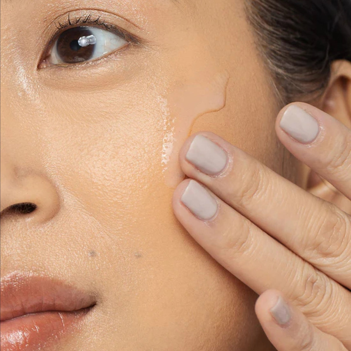 Vivier Acne Treatment System-Vivier Acne Treatment System