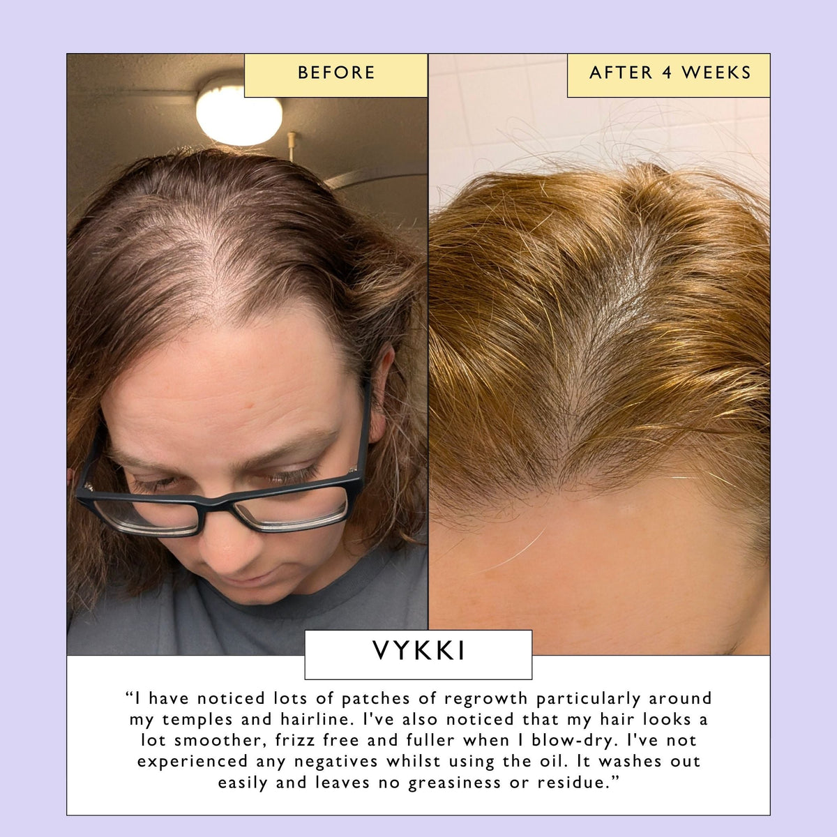 Scalp + Hair Oil with Bacuri Butter + Castor Oil-Scalp + Hair Oil with Bacuri Butter + Castor Oil