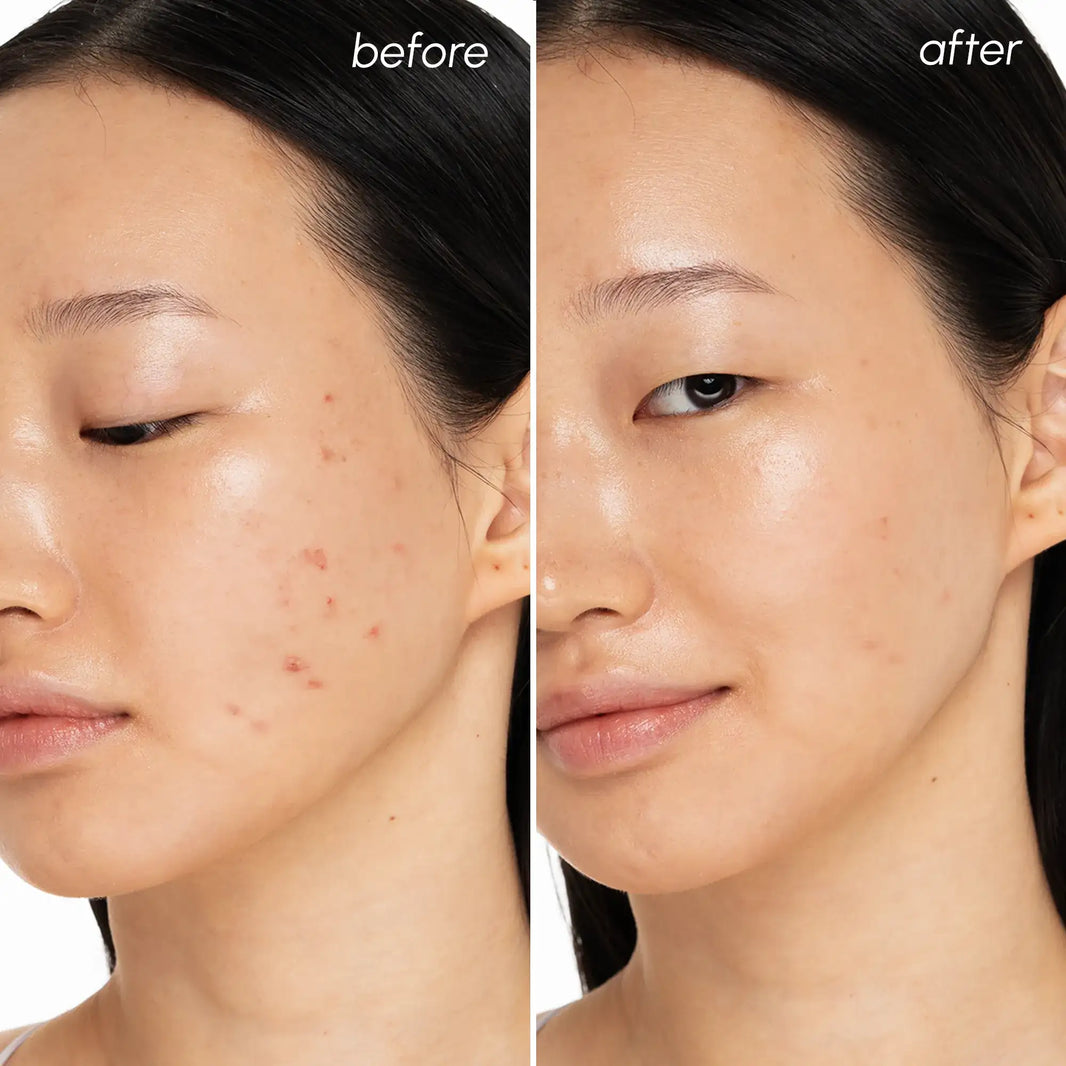 Witch Hazel Clearing Pads-Witch Hazel Clearing Pads