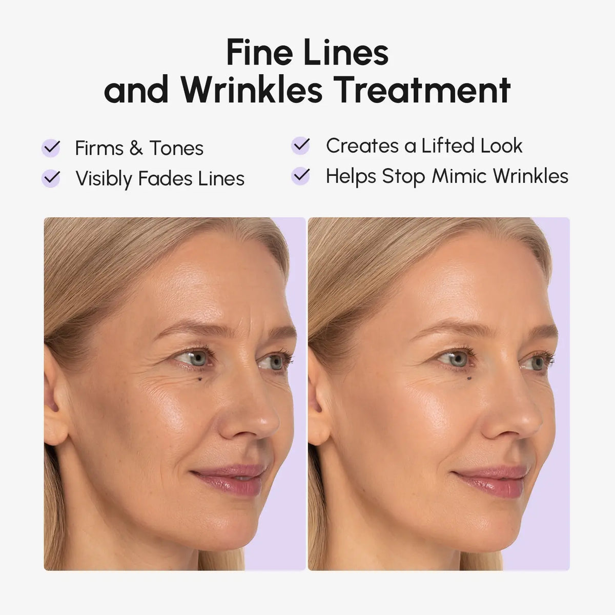 Anti-wrinkle Tape Patches-Anti-wrinkle Tape Patches