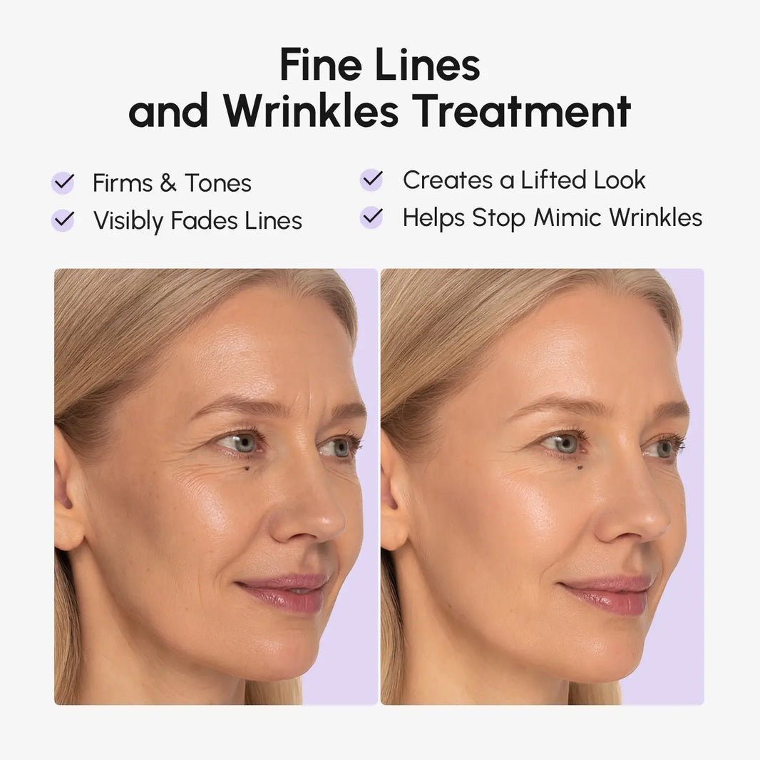 Anti-wrinkle Tape Patches-Anti-wrinkle Tape Patches