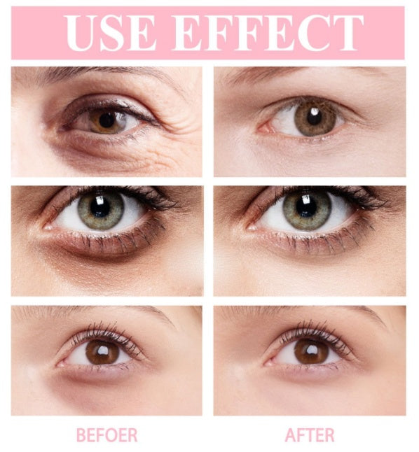 Moisturizing Retinol Eye Cream Stick-b904068d98ad12d3c58b5dd2d23f0668