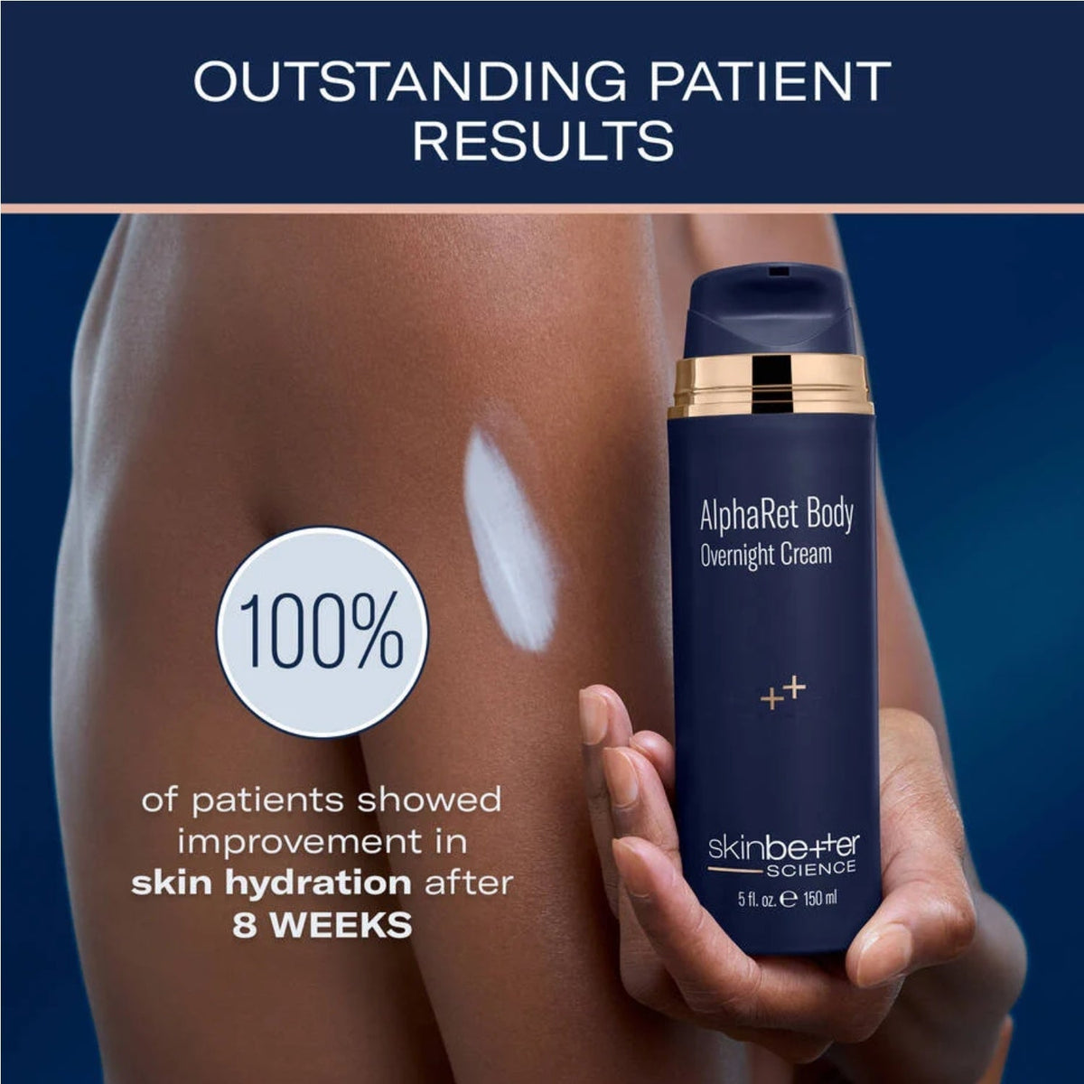 Skinbetter AlphaRet Body Overnight Cream 150 mL-Skinbetter AlphaRet Body Overnight Cream 150 mL