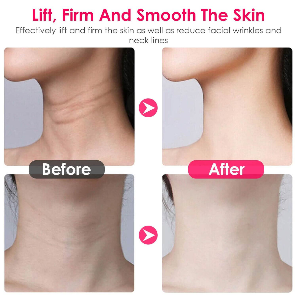 Anti Wrinkles Face Neck Massager Double Chin Reducer-Anti Wrinkles Face Neck Massager Double Chin Reducer