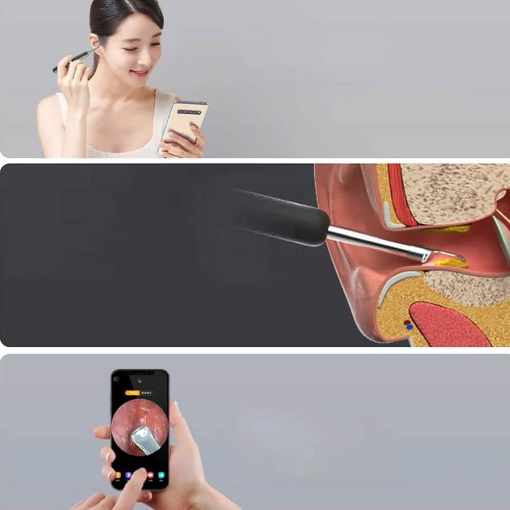 Bebird R1 Wireless Intelligent Visual Otoscope Ear Cleaner-Bebird R1 Wireless Intelligent Visual Otoscope Ear Cleaner