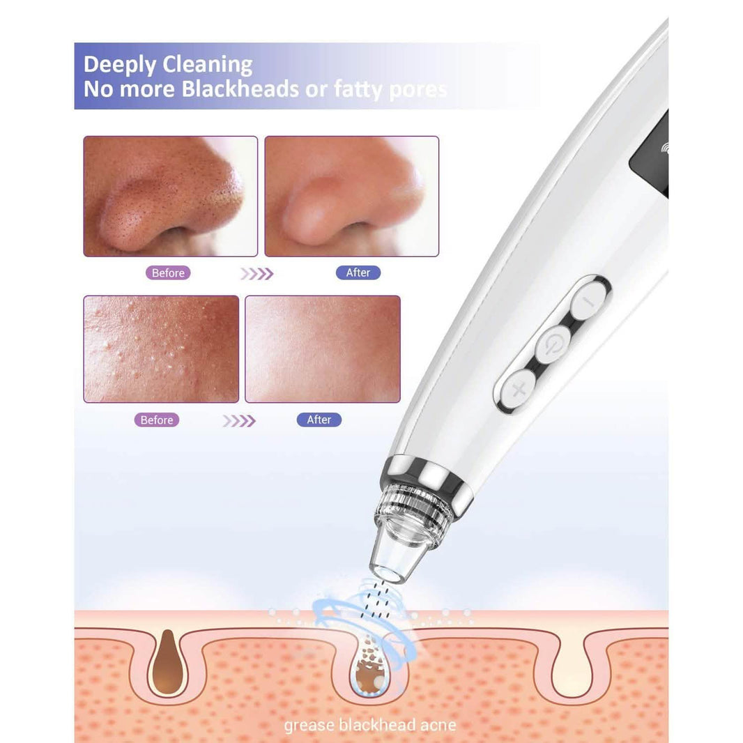 Blackhead Pore Vacuum Cleaner Remover-Blackhead Pore Vacuum Cleaner Remover