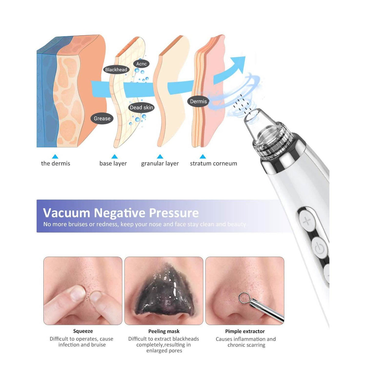 Blackhead Pore Vacuum Cleaner Remover-Blackhead Pore Vacuum Cleaner Remover