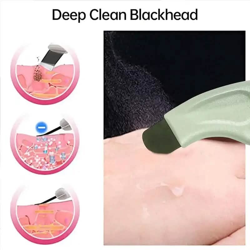 Blackhead Remover Tool Extractor-Blackhead Remover Tool Extractor
