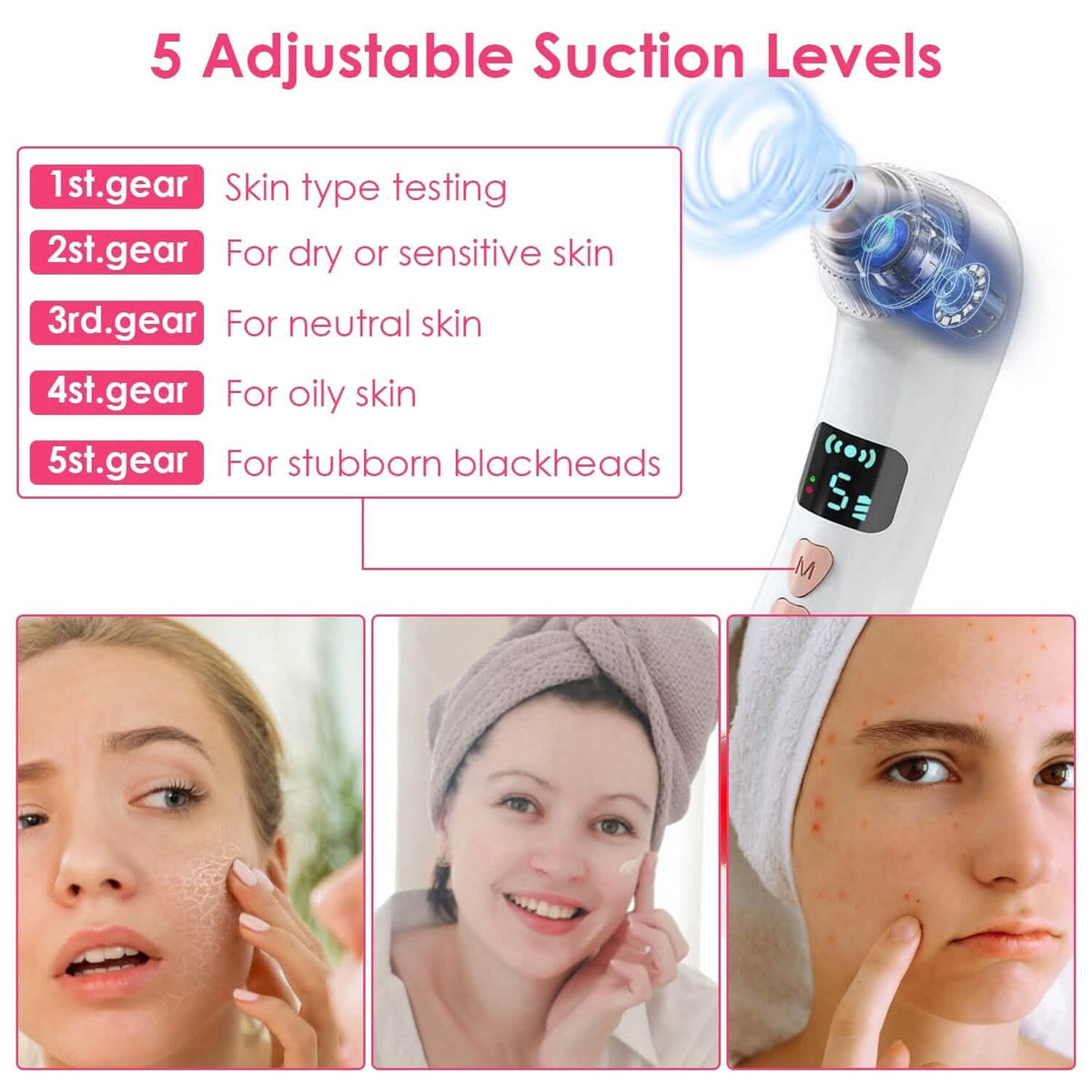 Blackhead Vacuum Remover Electric Blackhead Comedone Extractor-Blackhead Vacuum Remover Electric Blackhead Comedone Extractor