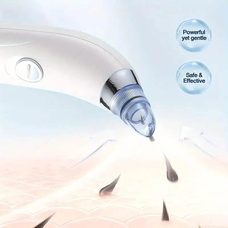 Blackhead Vacuum Remover, Powerful Portable Facial Pore Cleaner With 4 Probes-Blackhead Vacuum Remover, Powerful Portable Facial Pore Cleaner With 4 Probes
