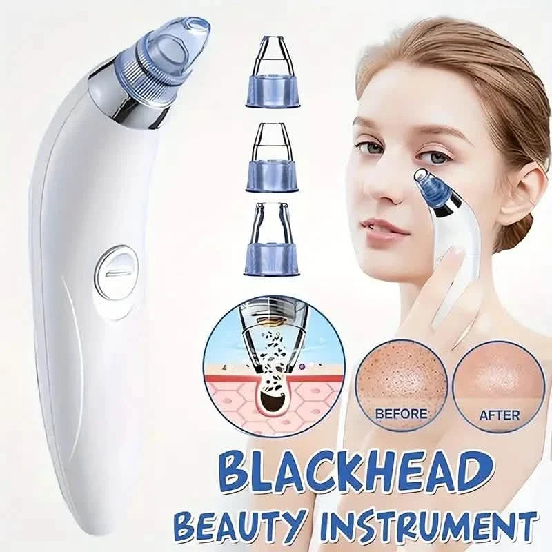 Blackhead Vacuum Remover, Powerful Portable Facial Pore Cleaner With 4 Probes-Blackhead Vacuum Remover, Powerful Portable Facial Pore Cleaner With 4 Probes
