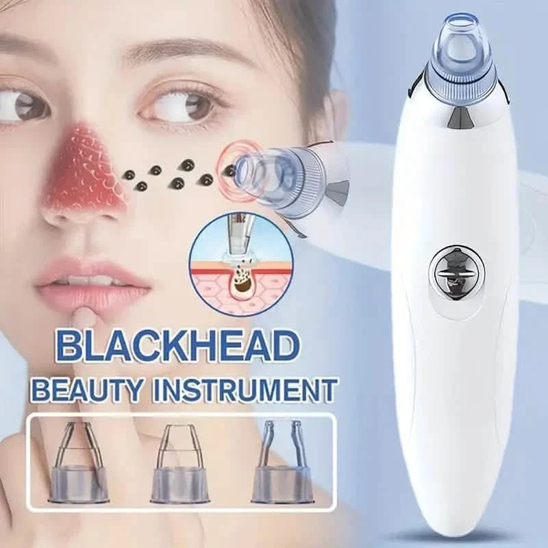 Blackhead Vacuum Remover, Powerful Portable Facial Pore Cleaner With 4 Probes-Blackhead Vacuum Remover, Powerful Portable Facial Pore Cleaner With 4 Probes