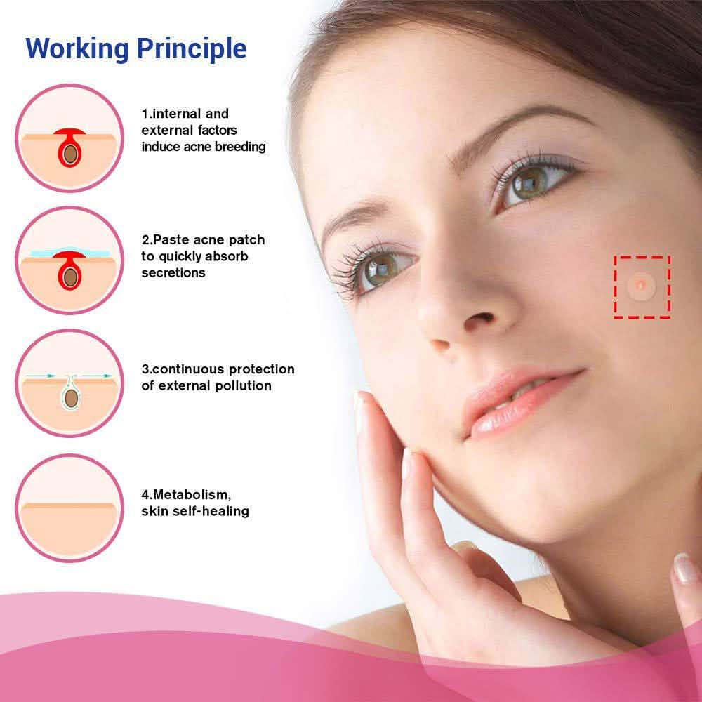 Blemish and Acne Treatment Skin Healing Spot Patches-Blemish and Acne Treatment Skin Healing Spot Patches