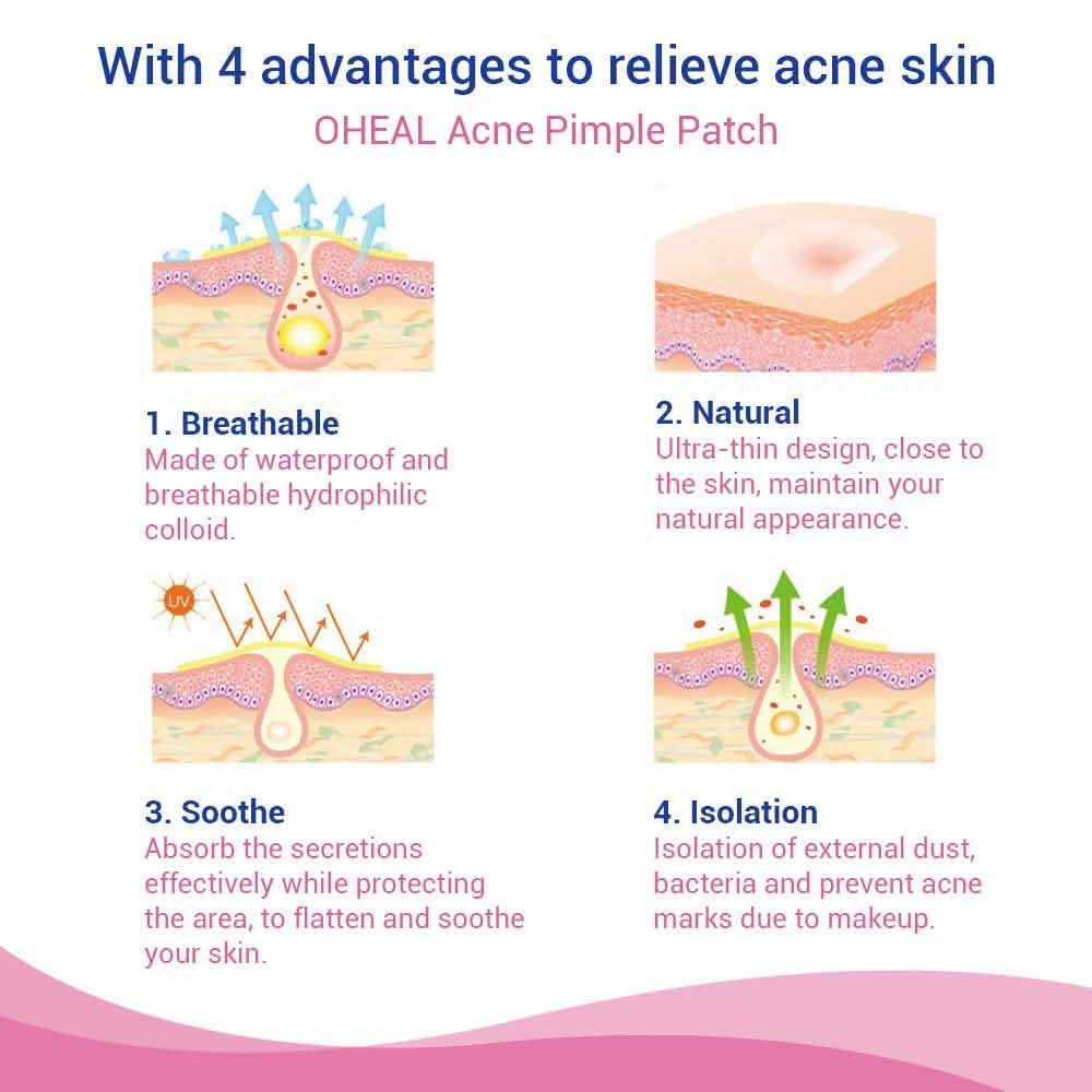 Blemish and Acne Treatment Skin Healing Spot Patches-Blemish and Acne Treatment Skin Healing Spot Patches
