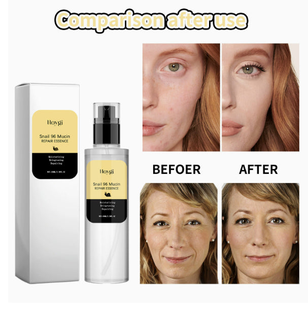 Snail 96 Mucin Repair-e43169db051d3b00819fc128d348b47c