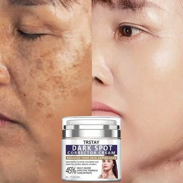 Dark Spot Corrector Cream Eliminates Dark Spots, Fades Dark Spots-Dark Spot Corrector Cream Eliminates Dark Spots, Fades Dark Spots
