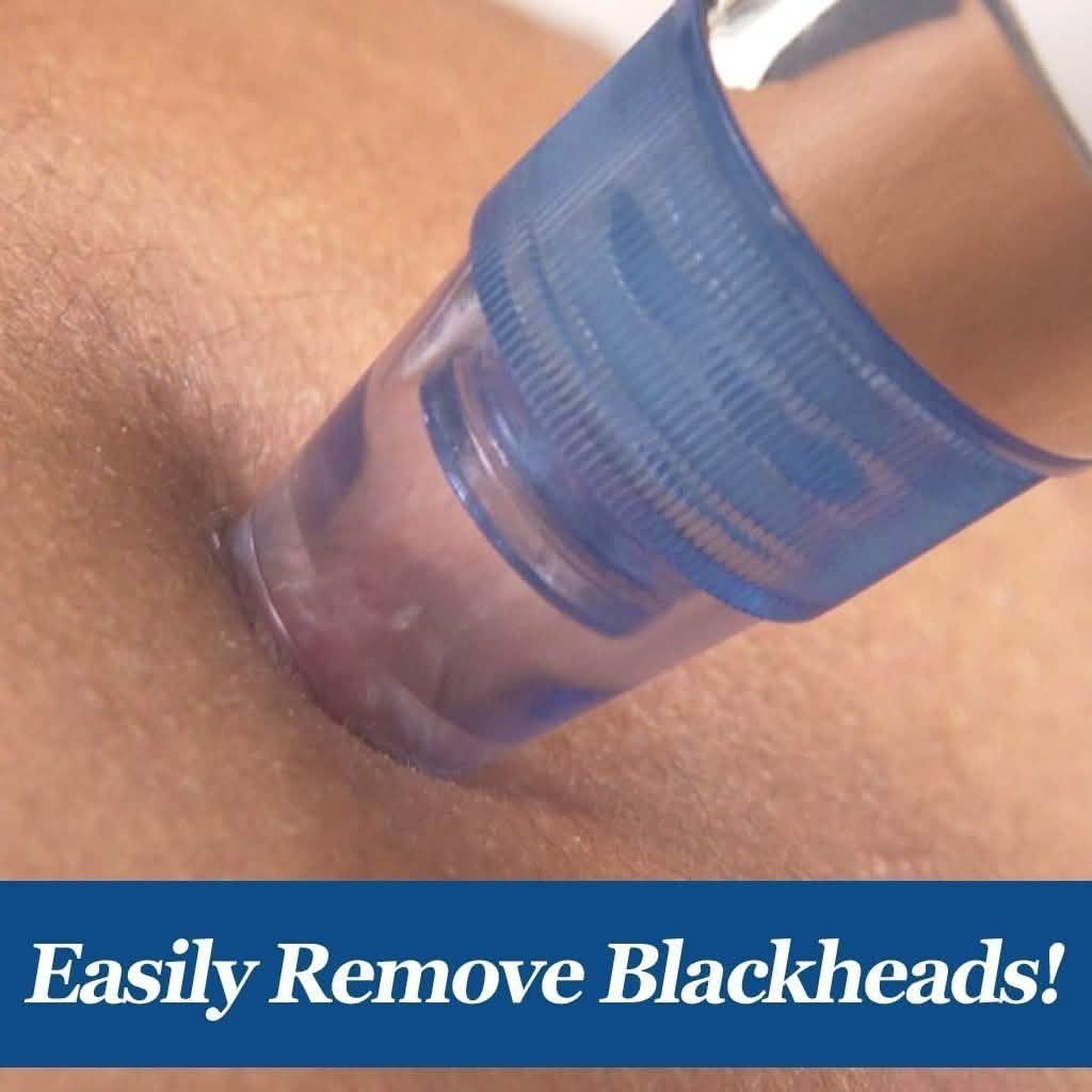 DermaSuction Blackhead Remover-DermaSuction Blackhead Remover