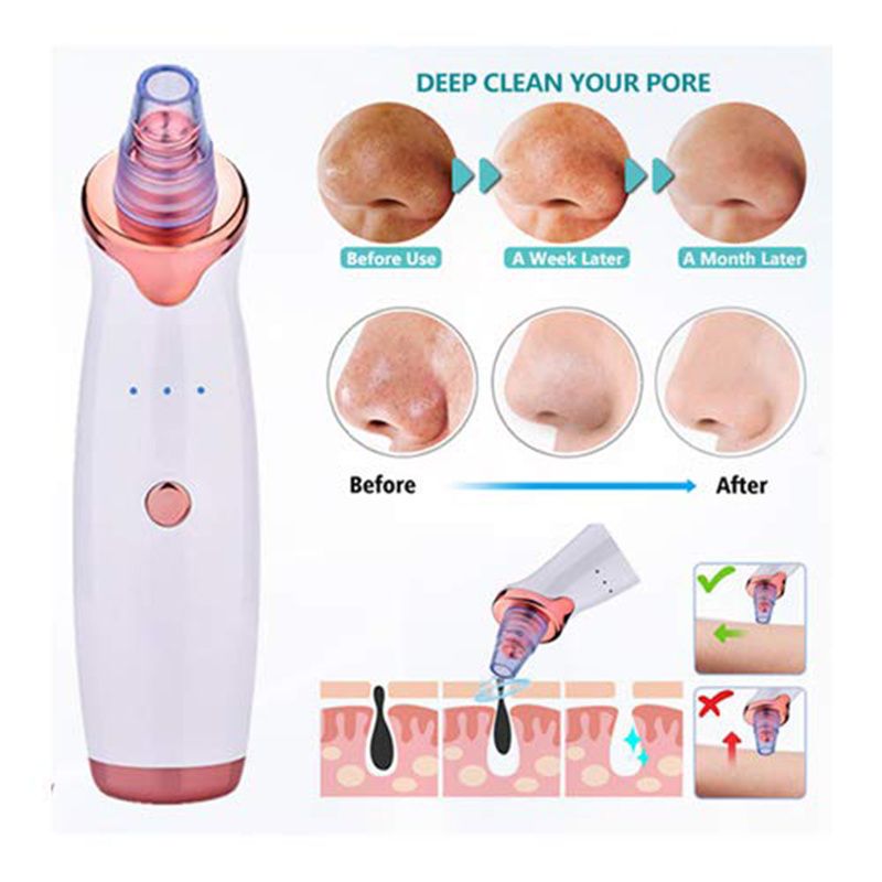 Rejuvenate Your Skin - Blackhead Remover Vacuum - Facial Pore Vacuum Extractor Electric Pore Cleaner-Rejuvenate Your Skin - Blackhead Remover Vacuum - Facial Pore Vacuum Extractor Electric Pore Cleaner