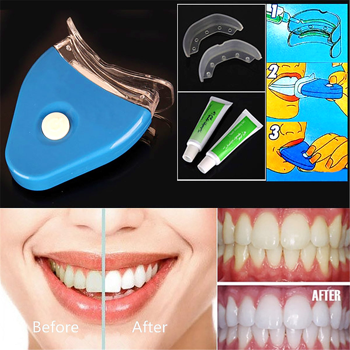 Oral Gel Teeth Tooth Whitening Whitener Dental Bleaching LED-e1cbf755c1c958b40b08710cbdc7eb8b