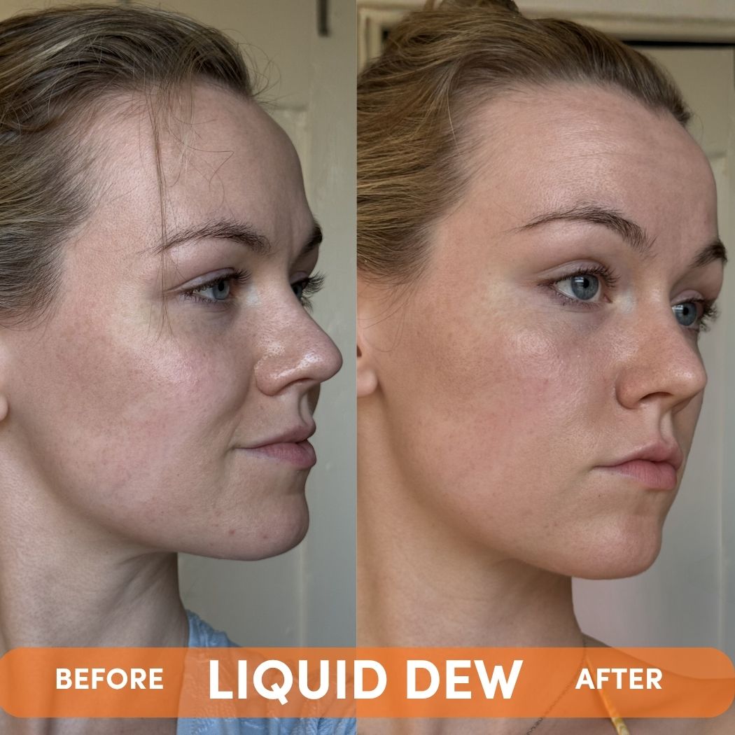 LIQUID DEW-LIQUID DEW