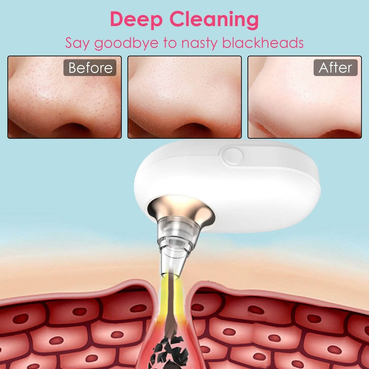 Electric Blackhead Comedone Extractor Tool Facial Pore Cleaner-Electric Blackhead Comedone Extractor Tool Facial Pore Cleaner