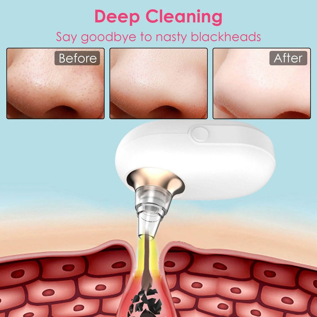 Electric Blackhead Comedone Extractor Tool Facial Pore Cleaner-Electric Blackhead Comedone Extractor Tool Facial Pore Cleaner