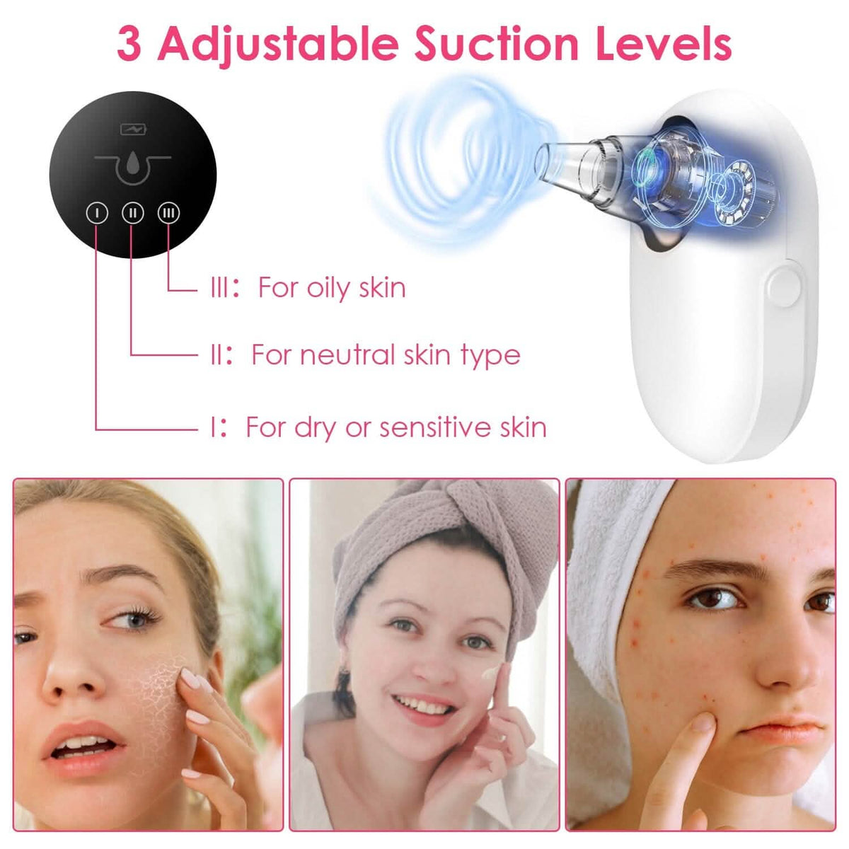 Electric Blackhead Comedone Extractor Tool Facial Pore Cleaner-Electric Blackhead Comedone Extractor Tool Facial Pore Cleaner