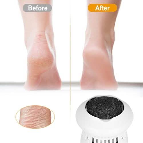Electric Callus Grinder USB Rechargeable-Electric Callus Grinder USB Rechargeable