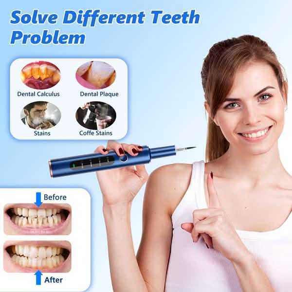 Electric Plaque Remover for Teeth, Rechargeable Teeth Cleaning Kit with 4 Modes-Electric Plaque Remover for Teeth, Rechargeable Teeth Cleaning Kit with 4 Modes