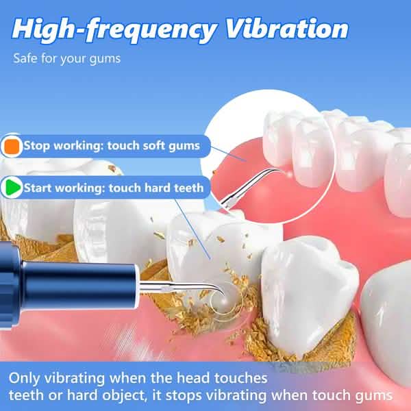 Electric Plaque Remover for Teeth, Rechargeable Teeth Cleaning Kit with 4 Modes-Electric Plaque Remover for Teeth, Rechargeable Teeth Cleaning Kit with 4 Modes