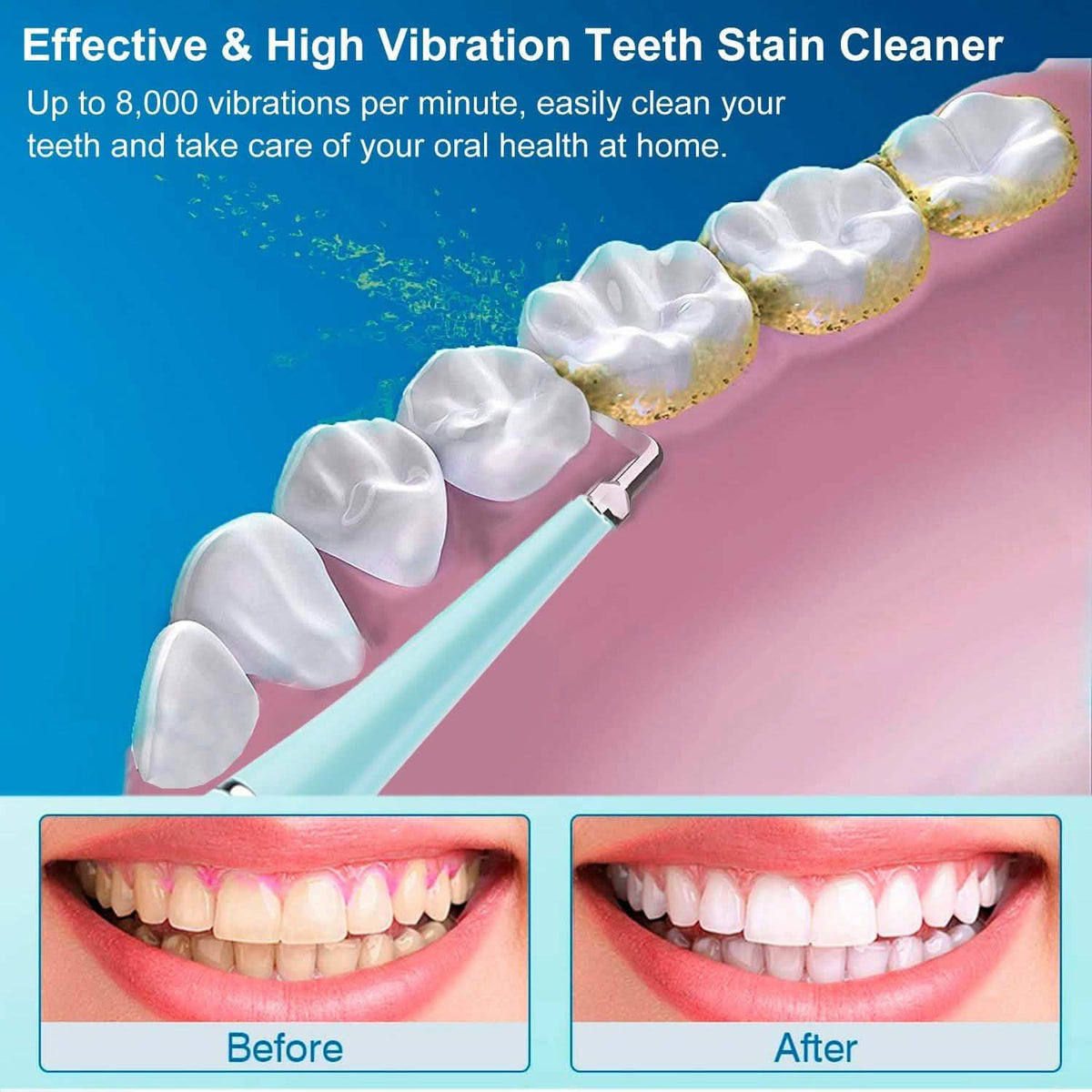 Electric Tartar Remover For Teeth-Electric Tartar Remover For Teeth