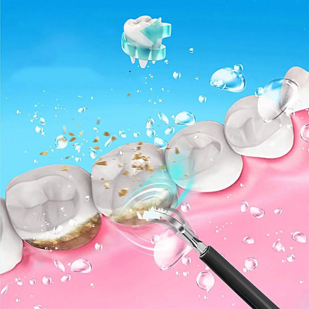 Electric Ultrasonic Dental Scaler-Electric Ultrasonic Dental Scaler