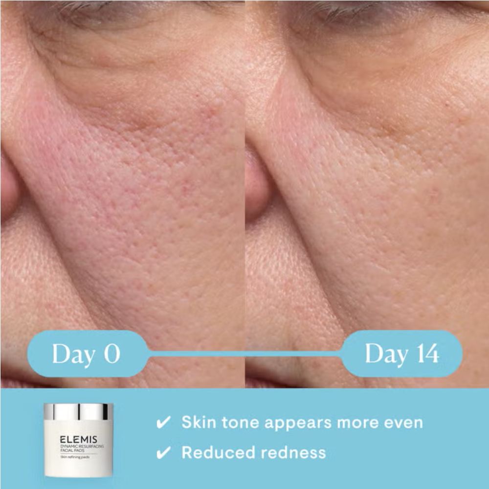 Elemis Dynamic Resurfacing Facial Pads 60pk-Elemis Dynamic Resurfacing Facial Pads 60pk