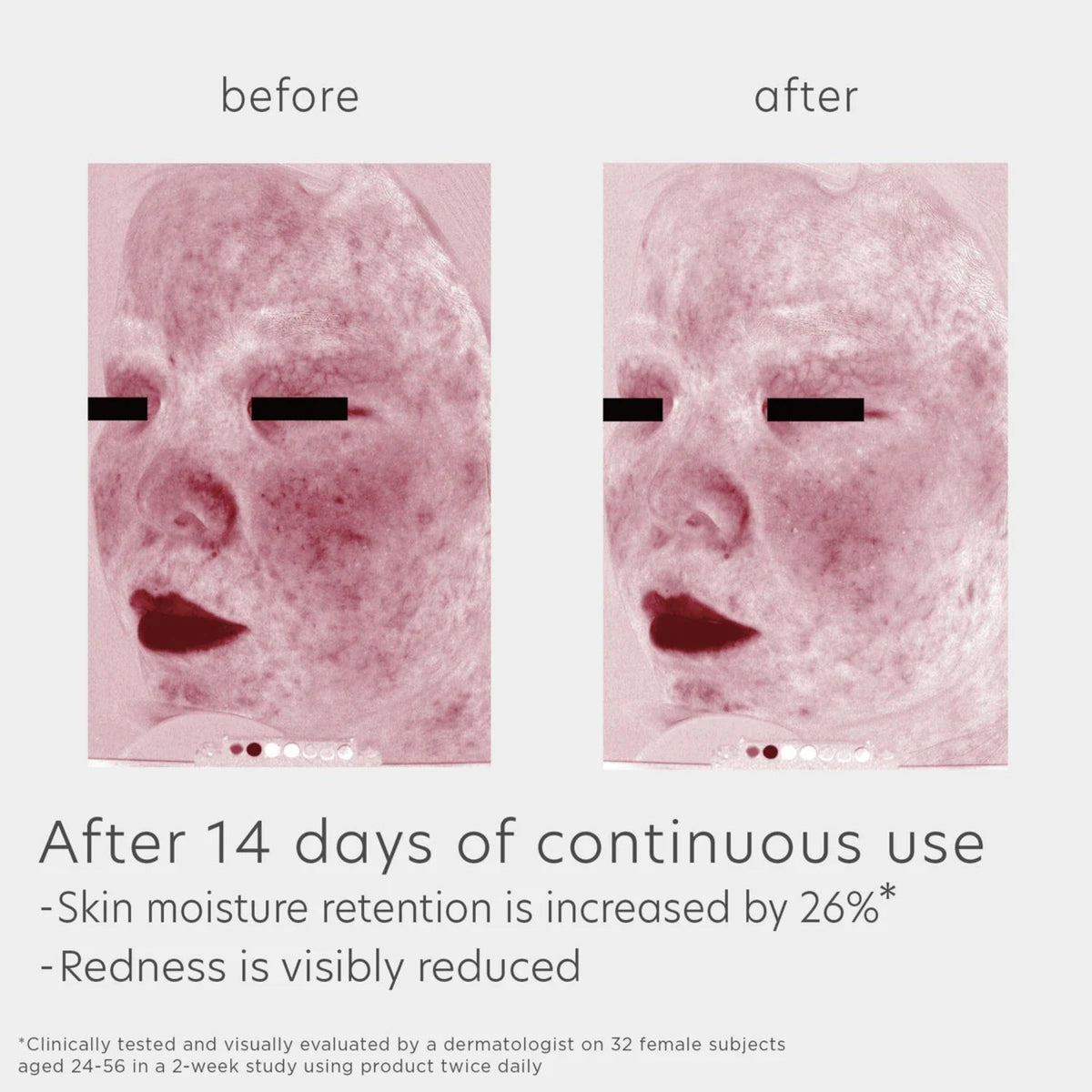 EltaMD Skin Recovery Amino Acid Foaming Cleanser-EltaMD Skin Recovery Amino Acid Foaming Cleanser