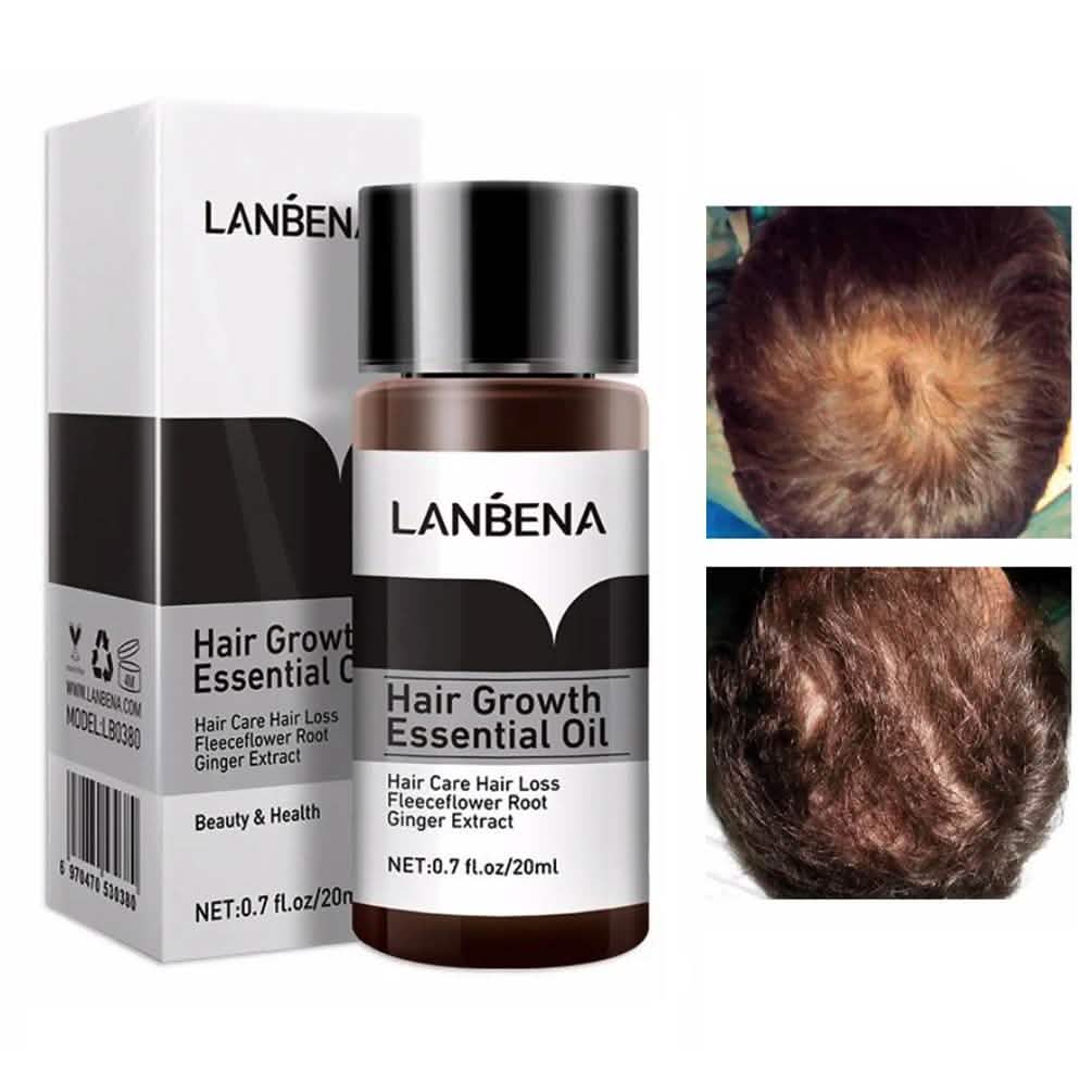 Essential Oil For Hair Growth And Hair Loss Treatment For Men And Women-Essential Oil For Hair Growth And Hair Loss Treatment For Men And Women