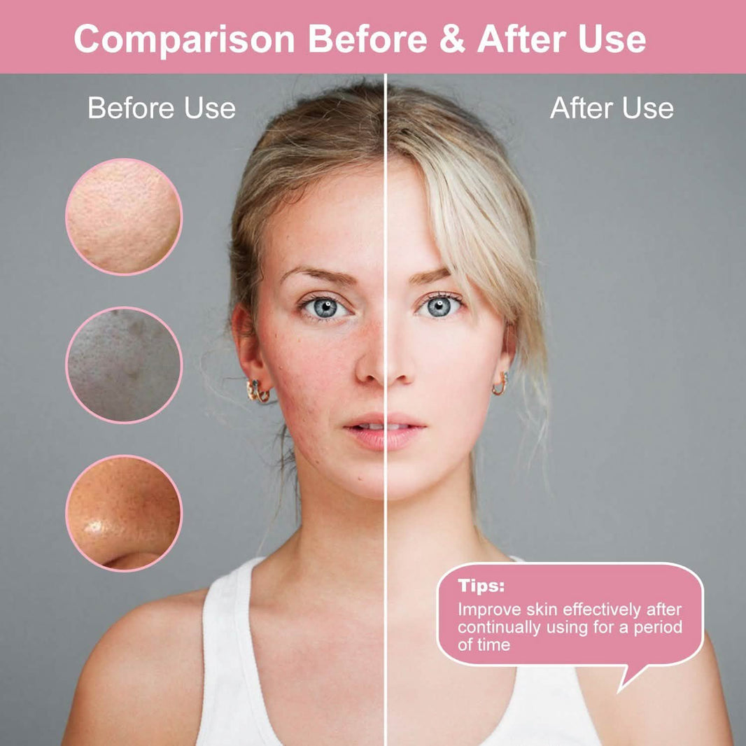 Facial Cleansing Brush IPX6 Waterproof 2 Speed Face Brush-Facial Cleansing Brush IPX6 Waterproof 2 Speed Face Brush