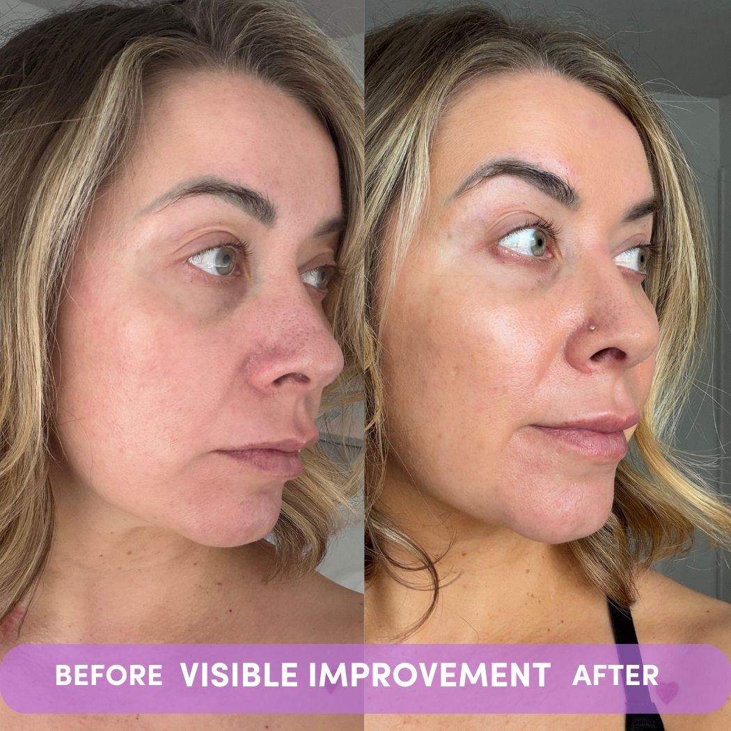 VISIBLE IMPROVEMENT-VISIBLE IMPROVEMENT