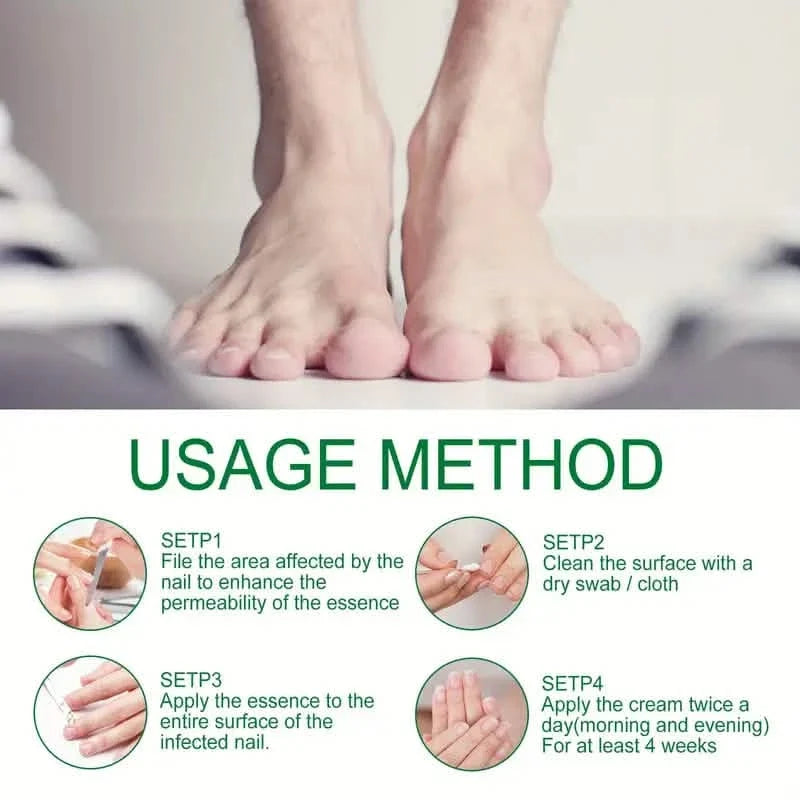 Ginger Nail Care Liquid Onychomycosis Fungus Repair Hand and Foot Nail Care-Ginger Nail Care Liquid Onychomycosis Fungus Repair Hand and Foot Nail Care