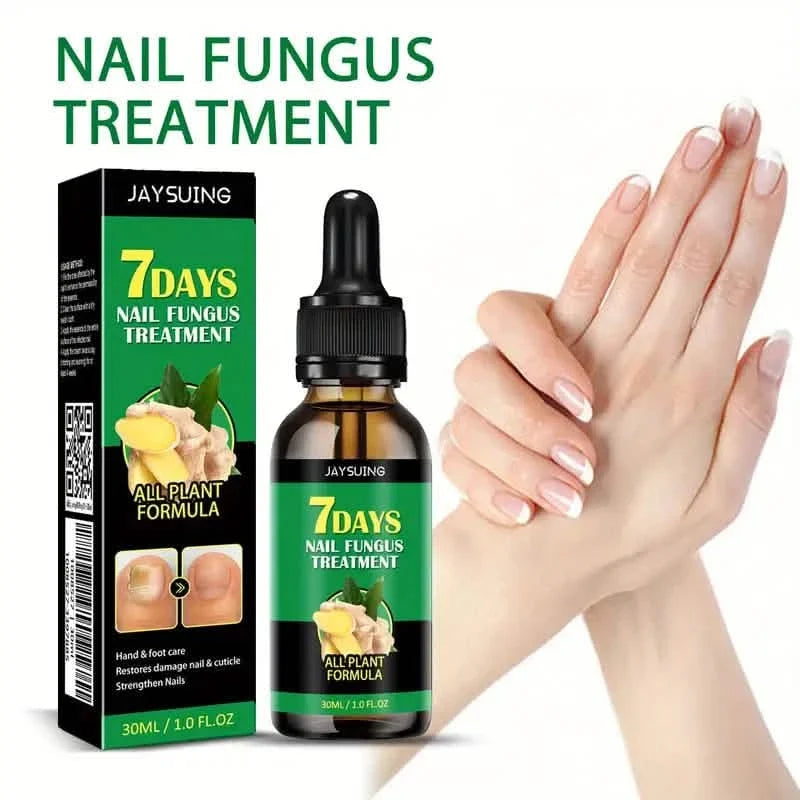 Ginger Nail Care Liquid Onychomycosis Fungus Repair Hand and Foot Nail Care-Ginger Nail Care Liquid Onychomycosis Fungus Repair Hand and Foot Nail Care