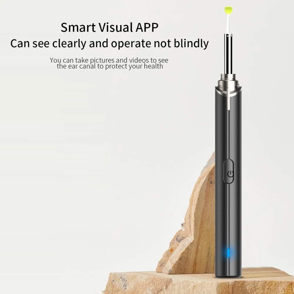 Intelligent Visual Ear Otoscope Inspection Tool-Intelligent Visual Ear Otoscope Inspection Tool