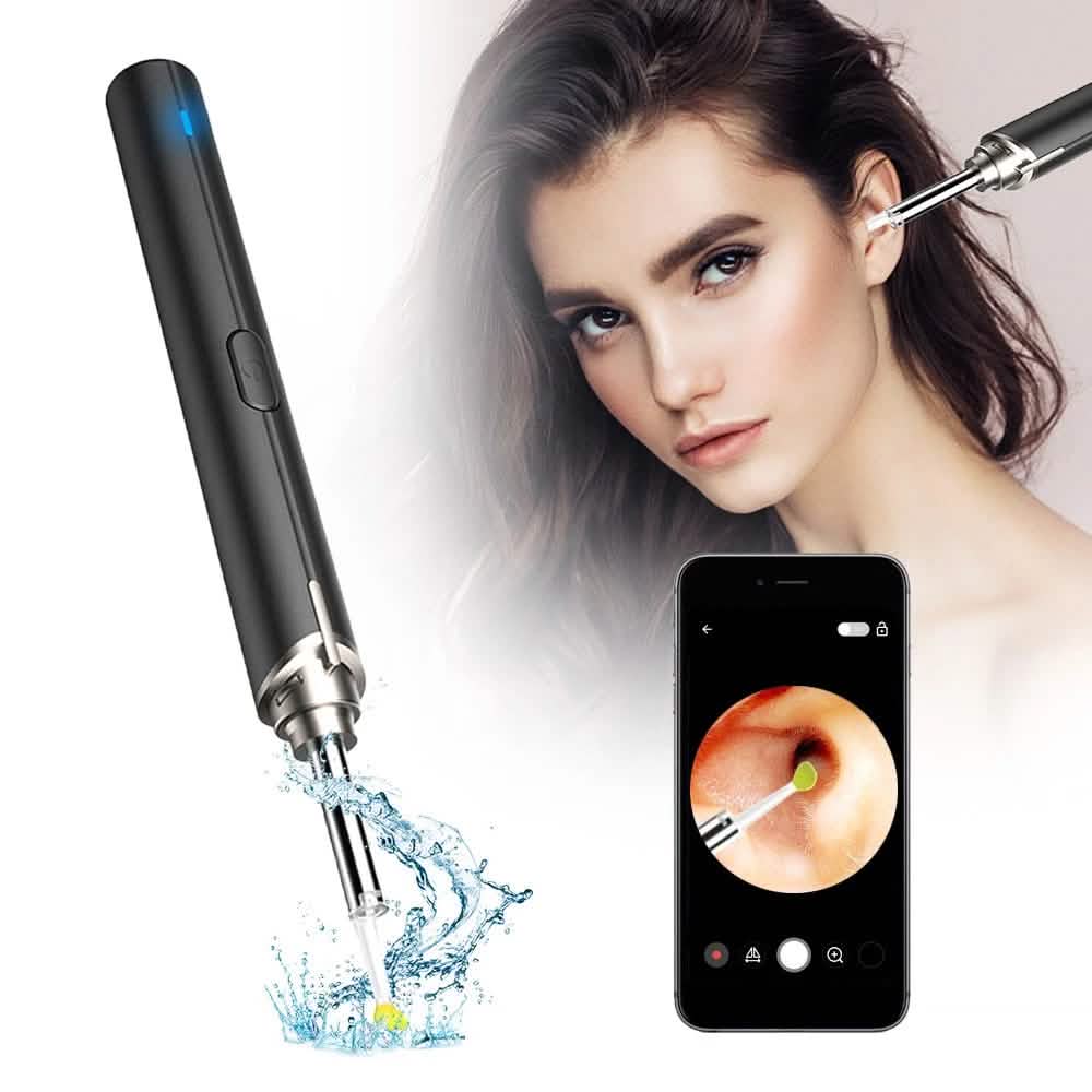 Intelligent Visual Ear Otoscope Inspection Tool-Intelligent Visual Ear Otoscope Inspection Tool