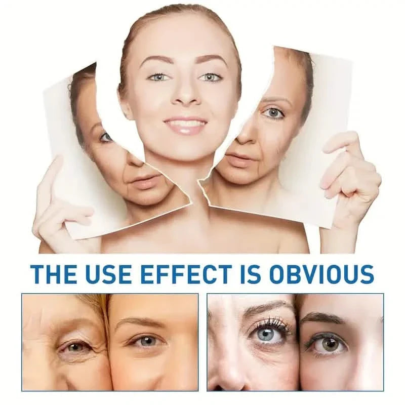 Intensive Anti Aging Botox Facial Serum - Collagen Serum For Skin With Vitamin C, Hyaluronic Acid and Niacinamide-Intensive Anti Aging Botox Facial Serum - Collagen Serum For Skin With Vitamin C, Hyaluronic Acid and Niacinamide