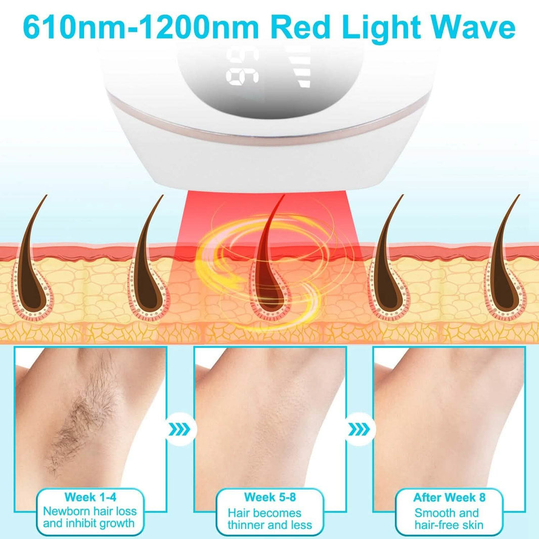 Laser Hair Removal Ice Cooling Permanent IPL-Laser Hair Removal Ice Cooling Permanent IPL