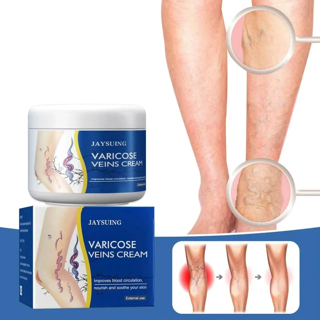 Pain Relief Leg Spider Veins Vasculitis Promote Circulation Smooth Metabolism 30g Exfoliation-Pain Relief Leg Spider Veins Vasculitis Promote Circulation Smooth Metabolism 30g Exfoliation