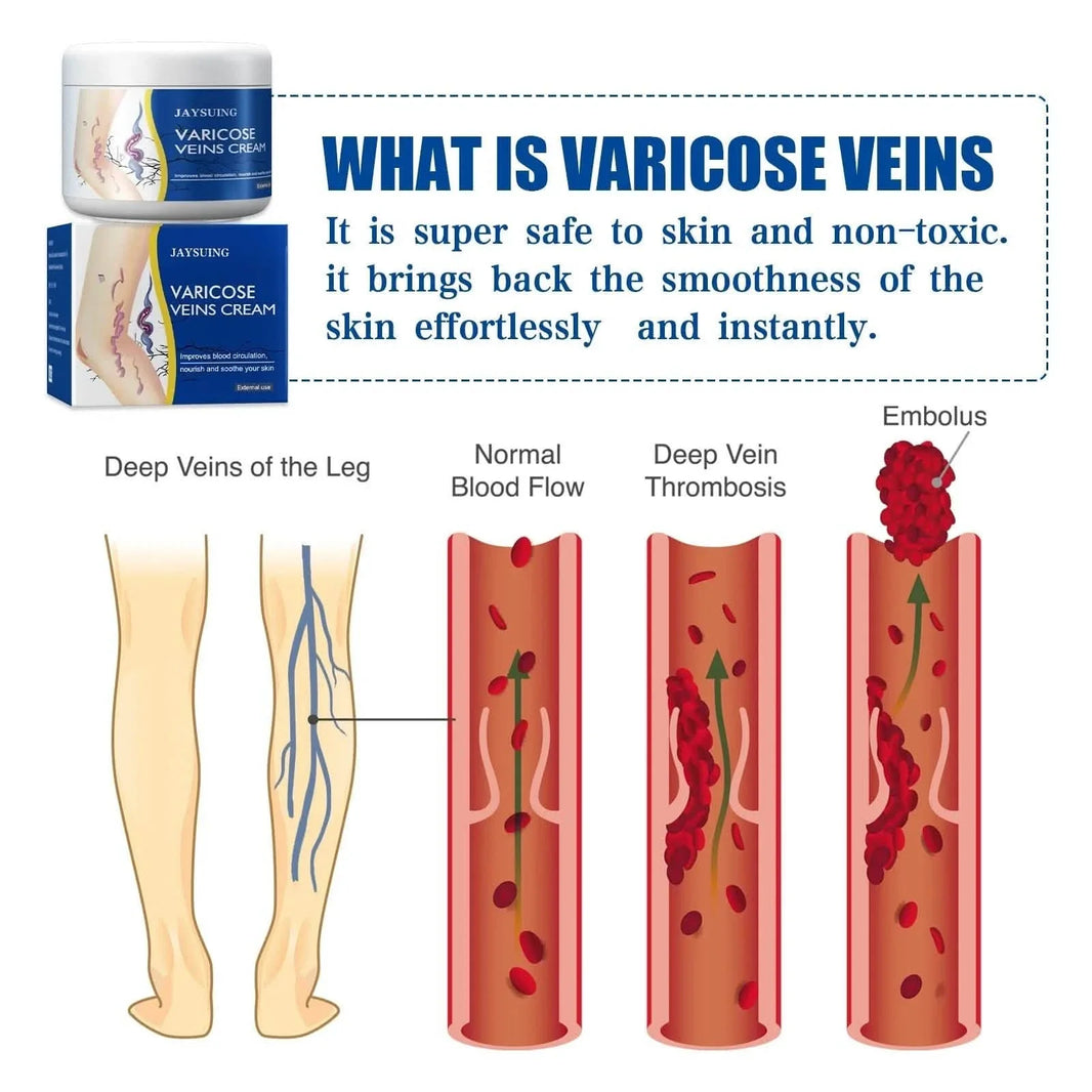 Pain Relief Leg Spider Veins Vasculitis Promote Circulation Smooth Metabolism 30g Exfoliation-Pain Relief Leg Spider Veins Vasculitis Promote Circulation Smooth Metabolism 30g Exfoliation