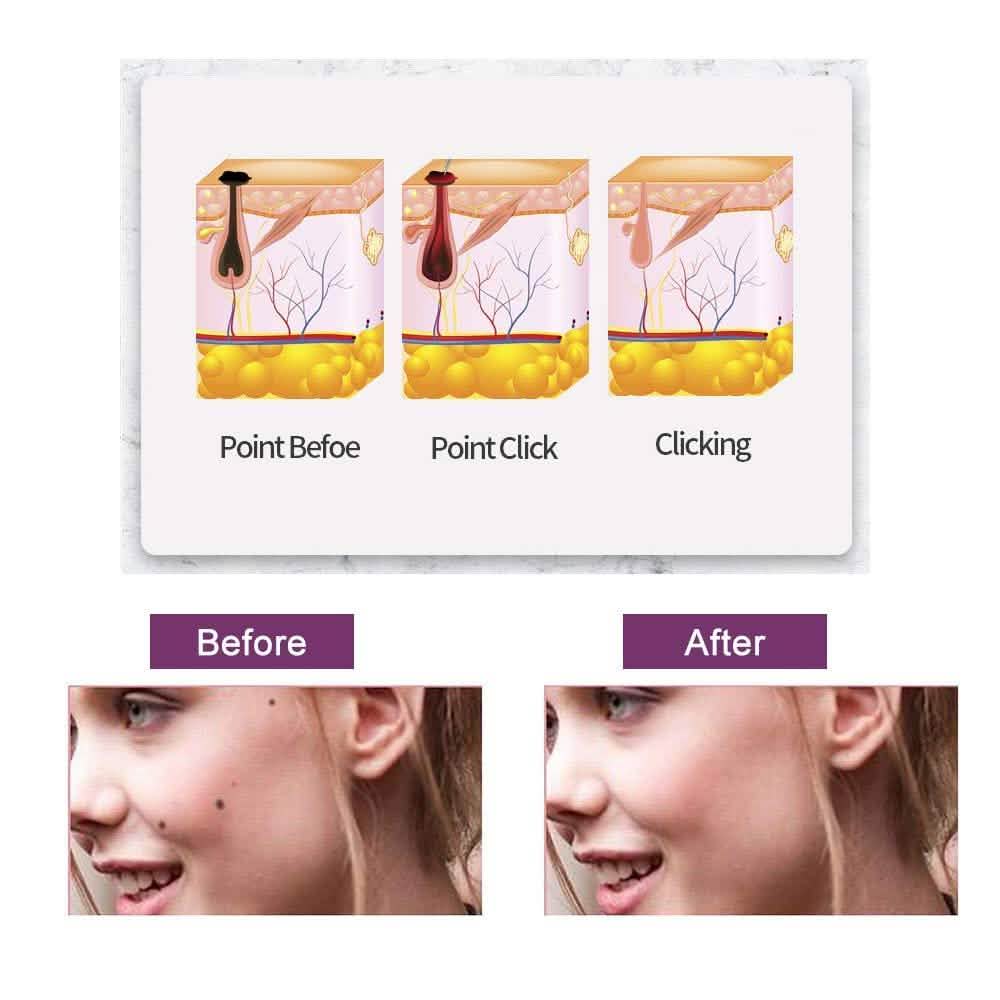 Portable Multi Level Beauty Equipment-Portable Multi Level Beauty Equipment