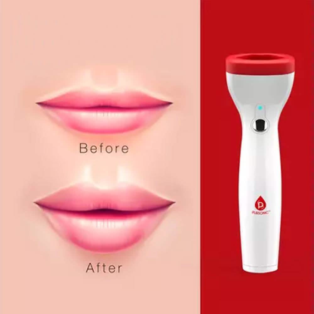 Pursonic Premium Automatic Fuller Lip Plumper-Pursonic Premium Automatic Fuller Lip Plumper