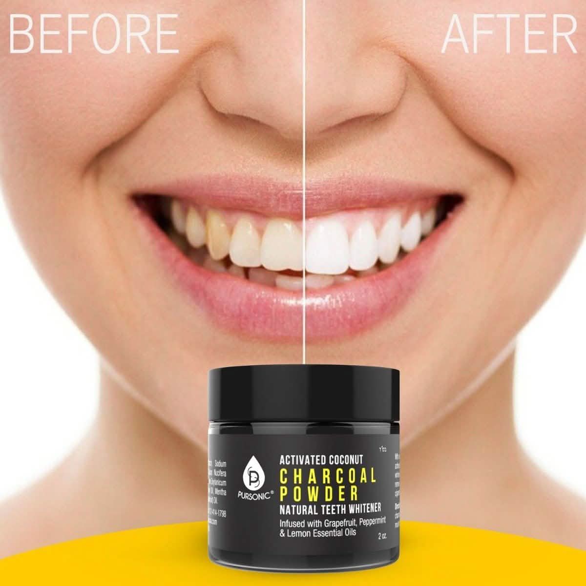 S520 Sonic Toothbrush - Accessories and Activated Coconut Charcoal Powder-S520 Sonic Toothbrush - Accessories and Activated Coconut Charcoal Powder